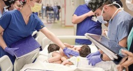 Cezayirli Yapışık İkizler Türkiye’de 9 Saat Süren Bir Operasyonla Kendi Bedenlerine Kavuştular