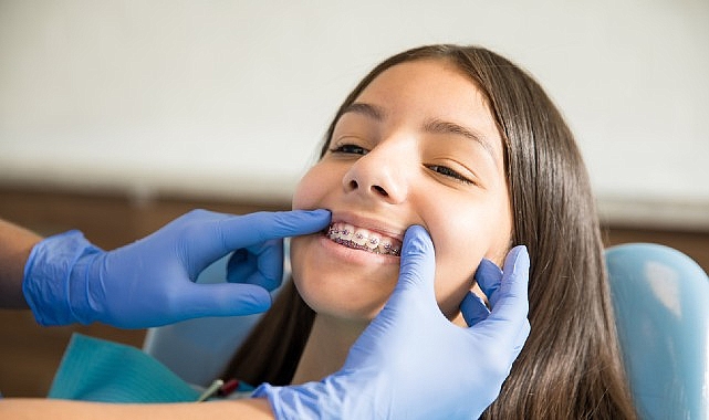 Ergenlik dönemi hem kızlar hem de erkekler için, ortodontik tedaviler açısından en ideal dönem olarak kabul ediliyor.