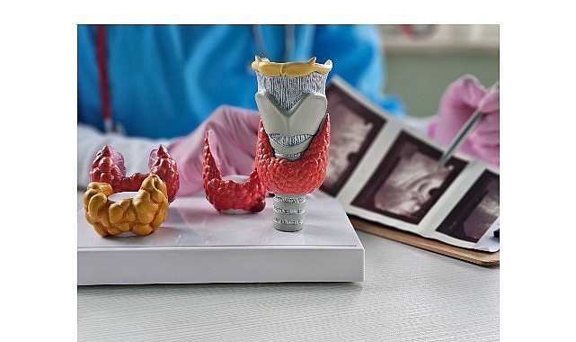 Tiroit ultrasonlarında sıkça görülen ancak çoğu kişinin adını bile duymadığı