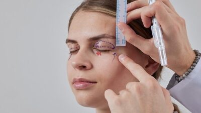 Yorgun ve yaşlı bir ifade ilk olarak göz çevresinde fark