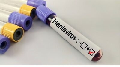 Çoğunlukla enfekte kemirgenlerin idrarı, dışkısı veya tükürüğüyle temas sonucu insanlara
