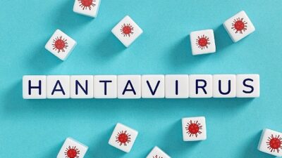 Enfeksiyon Hastalıkları ve Klinik Mikrobiyoloji Uzmanı Prof.